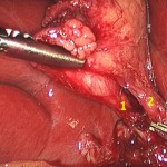 critical view surgery pix