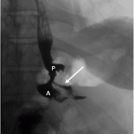 F4.medium