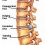 back and disc injuries/surgeries are our forte